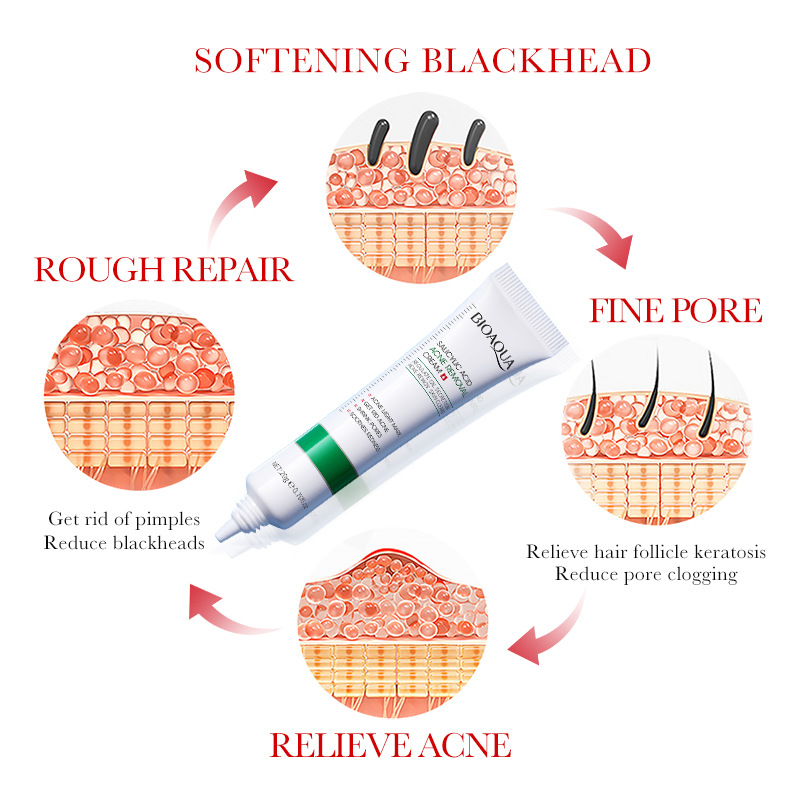1/2/3pcs BIOAQUA Salicylic Aci - огляд і ціна Salicylic Acid Blackhead Remover