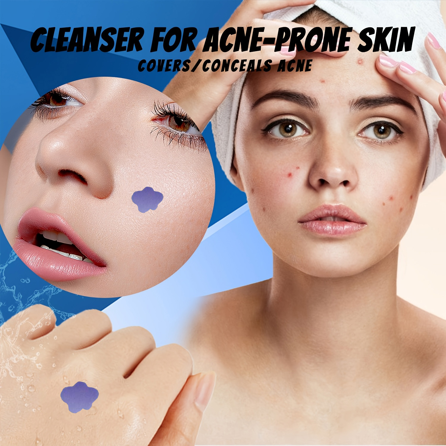 Microneedle Acne Pimple Patch  - огляд і ціна Skincare