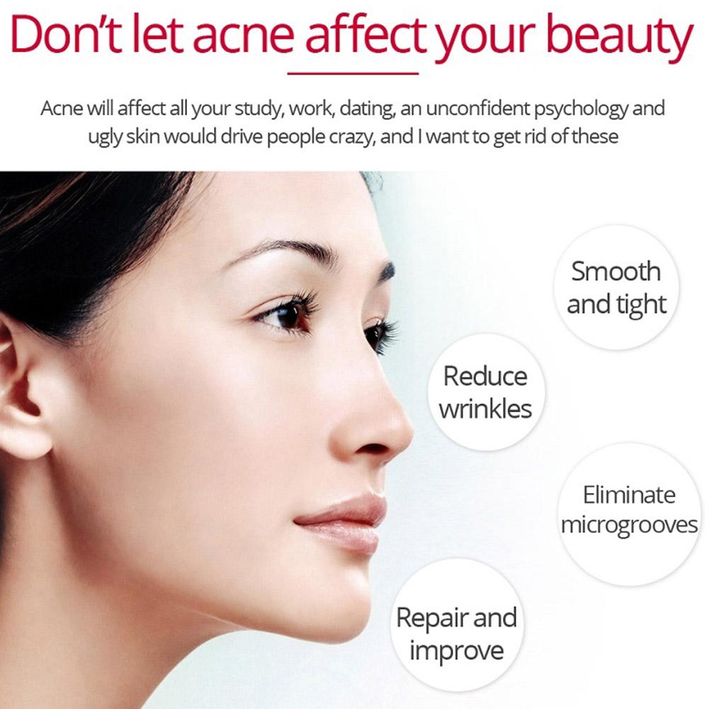 Retinol Lifting Firming Cream  - огляд і ціна Retinol Anti Wrinkle Cream