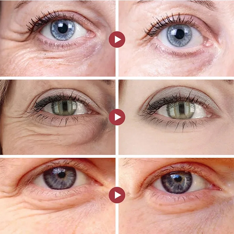 Wrinkle Remove Eyes Patches Fi - огляд і ціна Collagen Under Eye Patches